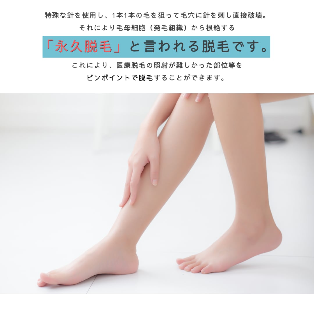 ニードル脱毛の仕組みを徹底解説！